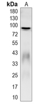 ZNF160 Rabbit Monoclonal Antibody