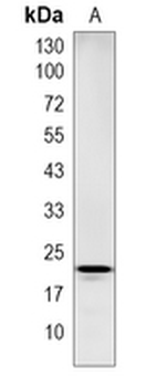 VSTM5 Rabbit Monoclonal Antibody