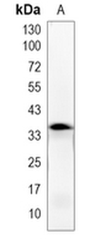 OR5I1 Rabbit Monoclonal Antibody