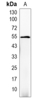 KRT83 Rabbit Monoclonal Antibody