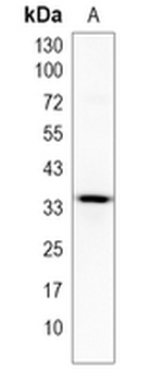 TMEM248 Rabbit Monoclonal Antibody