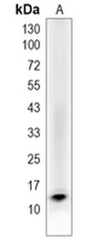 PDZK1IP1 Rabbit Monoclonal Antibody