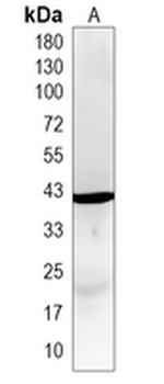 UPB1 Rabbit Monoclonal Antibody