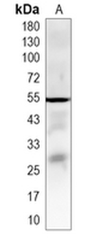 PTDSS2 Rabbit Monoclonal Antibody