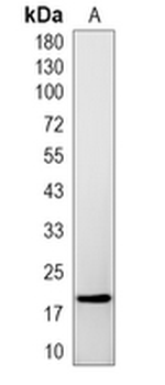 PPIL1 Rabbit Monoclonal Antibody