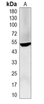 BTNL3 Rabbit Monoclonal Antibody