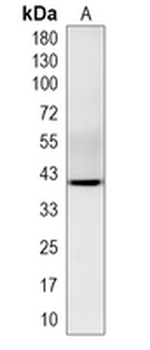 RBM43 Rabbit Monoclonal Antibody
