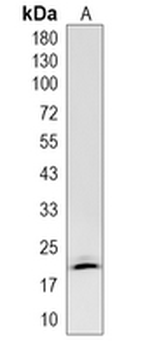 NUP62CL Rabbit Monoclonal Antibody
