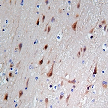 TBR1 Rabbit Monoclonal Antibody