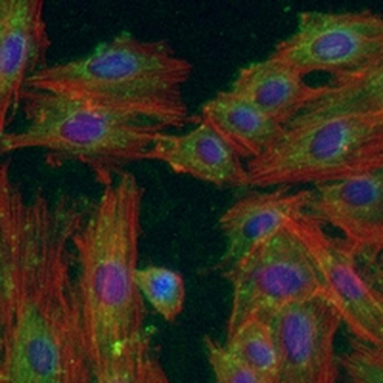ACACB Rabbit Monoclonal Antibody