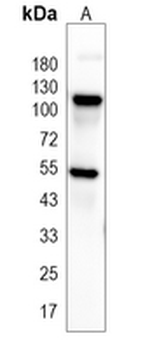 NF-kappaB p105/p50 Rabbit Monoclonal Antibody