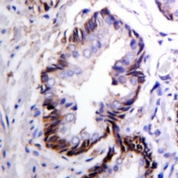 NF-kappaB p105/p50 Rabbit Monoclonal Antibody