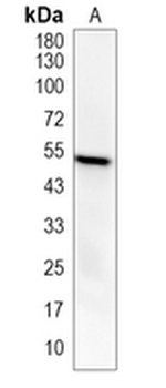 CD14 Rabbit Monoclonal Antibody