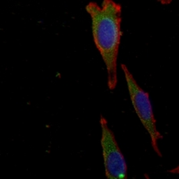 CD14 Rabbit Monoclonal Antibody