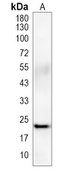 IL18 Rabbit Monoclonal Antibody