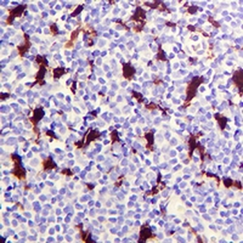 IL18 Rabbit Monoclonal Antibody