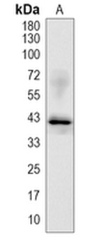 TPST2 Rabbit Monoclonal Antibody
