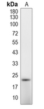 CD90 Rabbit Monoclonal Antibody
