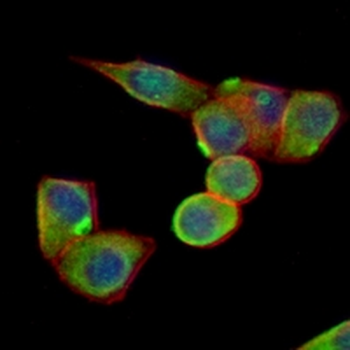 CD90 Rabbit Monoclonal Antibody