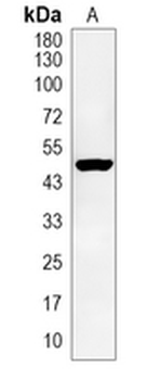 Cyclin E1 Rabbit Monoclonal Antibody