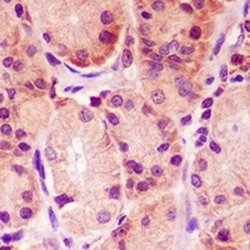 MCL1 Rabbit Monoclonal Antibody
