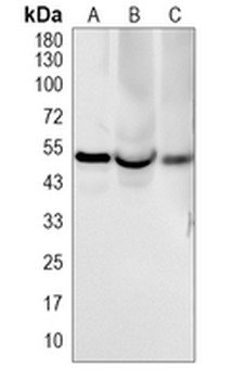 NF-kappaB p50 Rabbit Monoclonal Antibody
