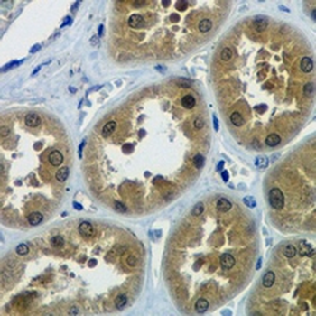 NF-kappaB p50 Rabbit Monoclonal Antibody