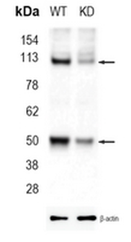 NF-kappaB p50 Rabbit Monoclonal Antibody