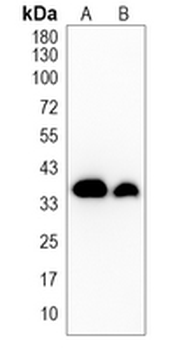Oligo2 Rabbit Monoclonal Antibody