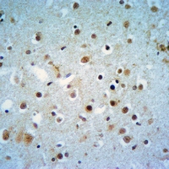 Oligo2 Rabbit Monoclonal Antibody