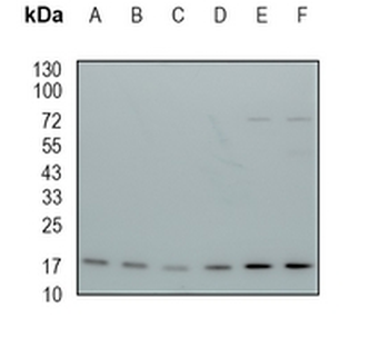 ARF5 Rabbit Monoclonal Antibody