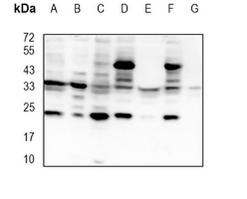 NEK7 Rabbit Monoclonal Antibody