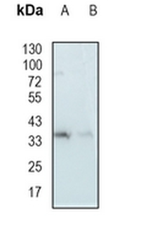 Tim50 Rabbit Monoclonal Antibody