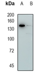 Timeless Rabbit Monoclonal Antibody