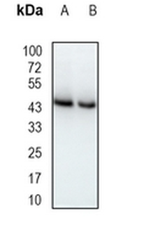 PRKAR2A Rabbit Monoclonal Antibody