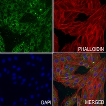 PRKAR2A Rabbit Monoclonal Antibody