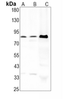 RSK4 Rabbit Monoclonal Antibody