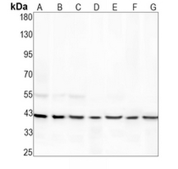 CCT alpha Rabbit Monoclonal Antibody