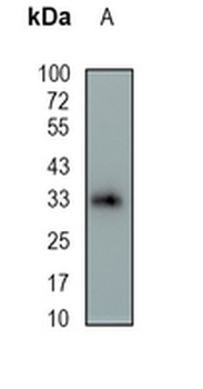 OTX2 Rabbit Monoclonal Antibody