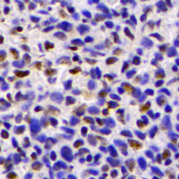 OTX2 Rabbit Monoclonal Antibody