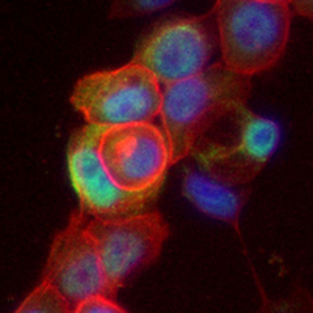 OTX2 Rabbit Monoclonal Antibody