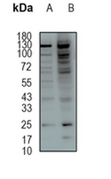 GSTK1 Rabbit Monoclonal Antibody