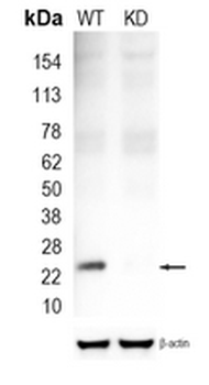 GSTK1 Rabbit Monoclonal Antibody