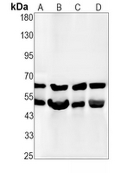 p68 Rabbit Monoclonal Antibody