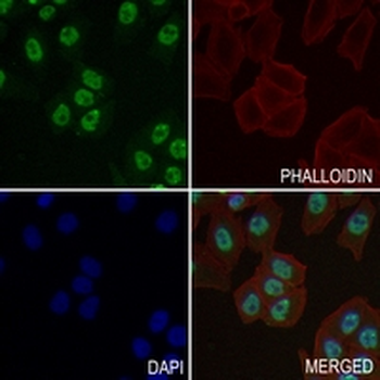 p68 Rabbit Monoclonal Antibody