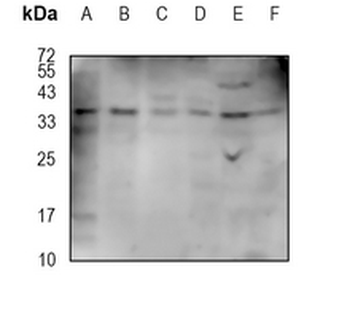 CRX Rabbit Monoclonal Antibody