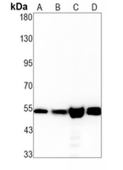 ERR gamma Rabbit Monoclonal Antibody