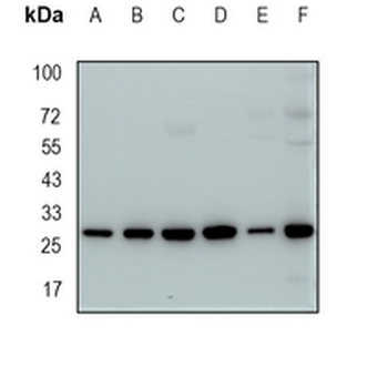 PGAM1 Rabbit Monoclonal Antibody