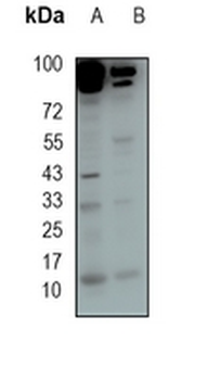 MSMB Rabbit Monoclonal Antibody