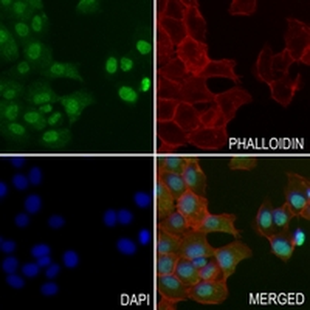 MSMB Rabbit Monoclonal Antibody